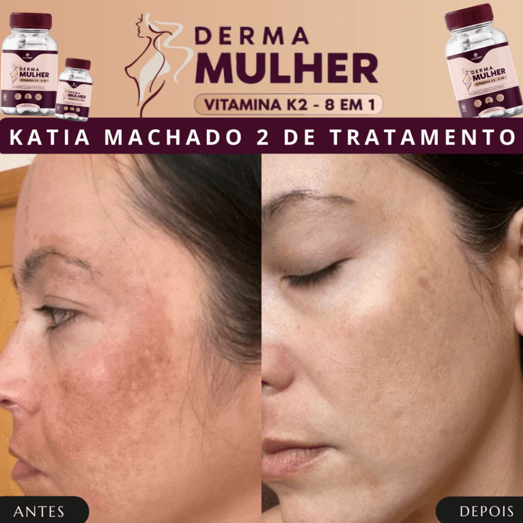 Derma mulher site oficial